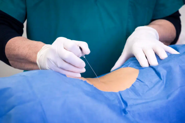 Spinal Injections